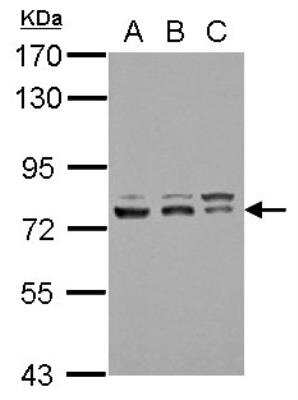 Western Blot: RAP30 Antibody [NBP2-20076] - Sample (30 ug of whole cell lysate) A: 293T B: A431 C: HeLa 7. 5% SDS PAGE gel, diluted at 1:3000.
