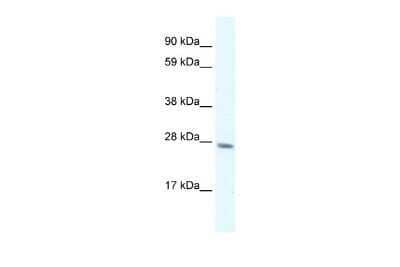 Western Blot: RAP30 Antibody [NBP3-17978] - WB Suggested Anti-RAP30 antibody Titration: 0.2-1 ug/ml. ELISA Titer: 1:312500. Positive Control: Human Liver