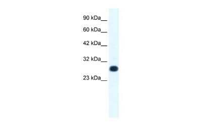 Western Blot: RAP30 Antibody [NBP3-17980] - WB Suggested Anti-RAP30 antibody Titration: 1.0ug/ml. Positive Control: HepG2 cell lysate