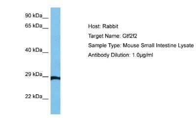 Western Blot: RAP30 Antibody [NBP3-17980] - Host: Mouse. Target Name: RAP30. Sample Tissue: Mouse Small Intestine. antibody Dilution: 1ug/ml