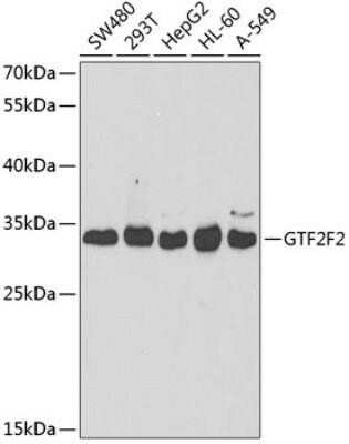 Western Blot: RAP30 Antibody [NBP3-17981] - Analysis of extracts of various cell lines, using RAP74 at 1:1000 dilution.Secondary antibody: HRP Goat Anti-Rabbit IgG (H+L) at 1:10000 dilution.Lysates/proteins: 25ug per lane.Blocking buffer: 3% nonfat dry milk in TBST.