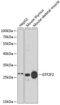 Western Blot: RAP30 Antibody [NBP3-17982] - Analysis of extracts of various cell lines, using RAP74 .Exposure time: 30s.