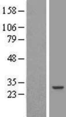 Western Blot RAP30 Overexpression Lysate