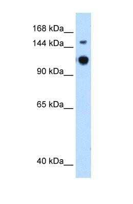 Western Blot: RAP6 Antibody [NBP1-53013] - HepG2 cell lysate, concentration 0.25ug/ml.