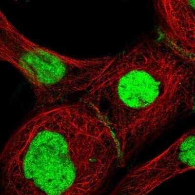 Immunocytochemistry/Immunofluorescence: RAP74 Antibody [NBP3-17974] - Immunofluorescent staining of human cell line A-431 shows localization to nucleus & cell junctions.