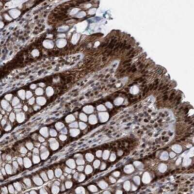 Immunohistochemistry: RAP74 Antibody [NBP3-17974] - Staining of human rectum shows strong nuclear and cytoplasmic positivity in glandular cells.