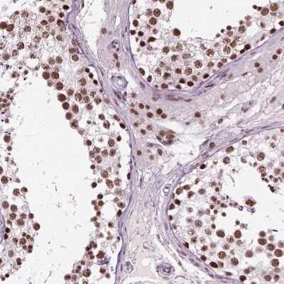 Immunohistochemistry: RAP74 Antibody [NBP3-17977] - Immunohistochemical staining of human testis shows strong nuclear positivity in cells in seminiferous ducts and Leydig cells.