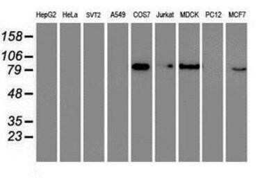 Western Blot: RAP74 Antibody (OTI4B10) - Azide and BSA Free [NBP3-17972] - Analysis of extracts (35ug) from 9 different cell lines by using anti-RAP74 monoclonal antibody.