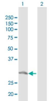 Western Blot: RAP74 Antibody [H00002963-D01P] - Analysis of GTF2F2 expression in transfected 293T cell line by GTF2F2 polyclonal antibody.Lane 1: GTF2F2 transfected lysate(27.50 KDa).Lane 2: Non-transfected lysate.