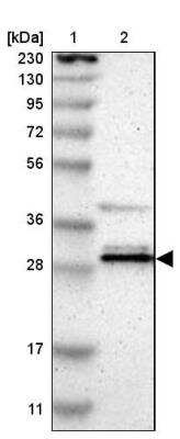 Western Blot: RAP74 Antibody [NBP1-89922] - Lane 1: Marker  [kDa] 230, 130, 95, 72, 56, 36, 28, 17, 11.  Lane 2: Human cell line RT-459