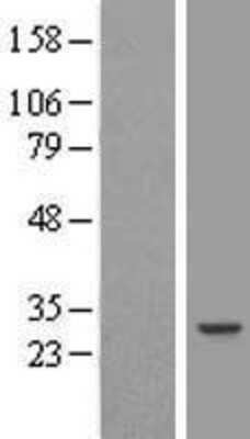Western Blot: RAP74 Overexpression Lysate (Adult Normal) [NBL1-11387] Left-Empty vector transfected control cell lysate (HEK293 cell lysate); Right -Over-expression Lysate for RAP74.