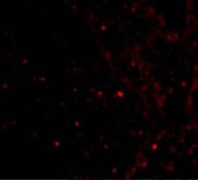 Immunocytochemistry/Immunofluorescence: RAP80 Antibody [NBP1-76828] - Immunofluorescence of RAP80 in Human Spleen cells with RAP80 antibody at 20 ug/mL.