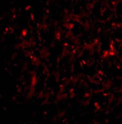 Immunocytochemistry/Immunofluorescence: RAP80 Antibody [NBP1-76829] - Immunofluorescence of RAP80 in human spleen tissue with RAP80 antibody at 20 ug/mL.