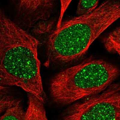 Immunocytochemistry/Immunofluorescence: RAP80 Antibody [NBP1-87156] - Staining of human cell line U-2 OS shows localization to nucleus & nuclear bodies. Antibody staining is shown in green.