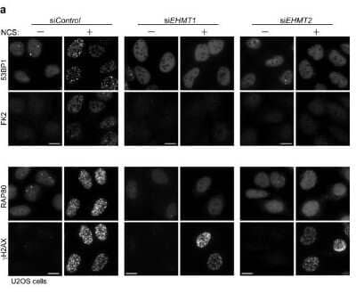 Immunocytochemistry/Immunofluorescence: RAP80 Antibody [NBP1-87156] - EHMT1 and EHMT2 are required for accumulation of ubiquitin conjugates and repair factors at DNA damage sites. ICC/IF analysis of U2OS  cells transfected with indicated siRNA, and co-immunostained with indicated antibodies at 2 h after exposure to neocarzinostatin (NCS, 50 ng/ml for 15 min). Representative images of each treated or control cells shown. DNA damage induced foci are quantified as the % of cells with more than 5 large foci in nuclei after background subtraction, each based on at least 150 cells, 3 independent experiments (right). Error bars represent standard deviation (SD). Statistical significance was calculated using two-tailed, unpaired t-test compared with control cells; *P < 0.0001. Scale bar, 10 um. Image collected and cropped by CiteAb from the following publication (//www.nature.com/articles/s41598-018-29239-3), licensed under a CC-BY license.