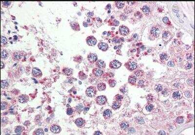 Immunohistochemistry-Paraffin: RAP80 Antibody [NBP1-45228] - (3.75ug/ml) staining of paraffin embedded Human Testis. Steamed antigen retrieval with citrate buffer pH 6, AP-staining.