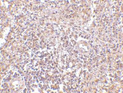 Immunohistochemistry-Paraffin: RAP80 Antibody [NBP1-76829] - Human spleen tissue with RAP80 antibody at 2.5 ug/ml.