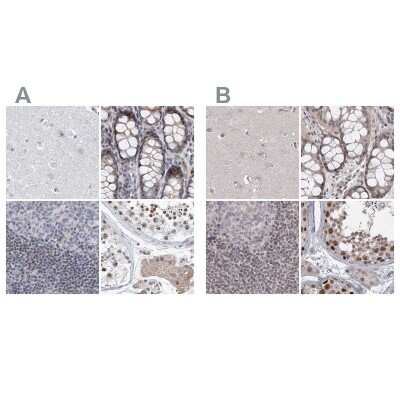 Immunohistochemistry-Paraffin: RAP80 Antibody [NBP1-87156] - Staining of human cerebral cortex, colon, lymph node and testis using Anti-UIMC1 antibody NBP1-87156 (A) shows similar protein distribution across tissues to independent antibody NBP1-87157 (B).