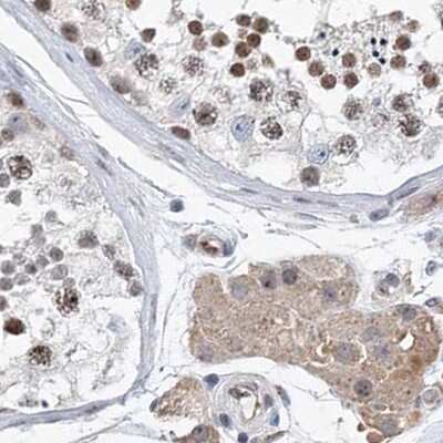 Immunohistochemistry-Paraffin: RAP80 Antibody [NBP1-87156] - Staining of human testis.