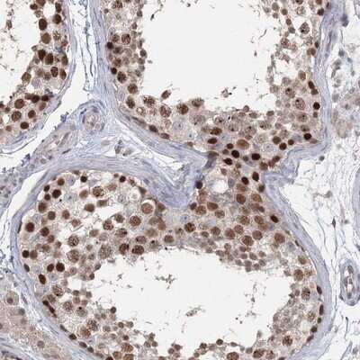 Immunohistochemistry-Paraffin: RAP80 Antibody [NBP1-87157] - Staining of human testis shows strong nuclear positivity in seminiferus tubules.