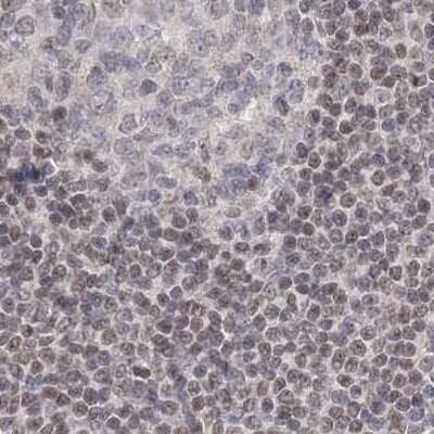 Immunohistochemistry-Paraffin: RAP80 Antibody [NBP1-87157] - Staining of human lymph node.