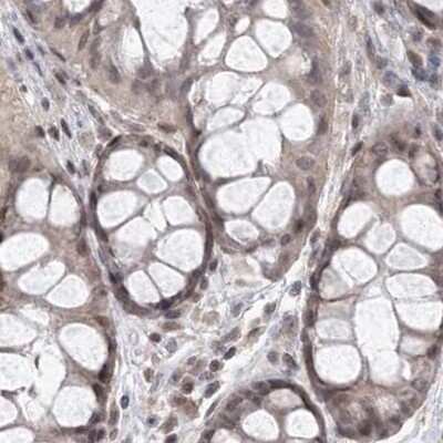 Immunohistochemistry-Paraffin: RAP80 Antibody [NBP1-87157] - Staining of human colon.