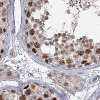 Immunohistochemistry-Paraffin: RAP80 Antibody [NBP1-87157] - Staining of human testis.