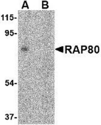 Western Blot: RAP80 Antibody [NBP1-76828] - 293 cell lysate in (A) the absence and (B) presence of blocking peptide with RAP80 antibody at 2 ug/ml.