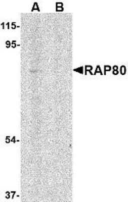 Western Blot: RAP80 Antibody [NBP1-76829] - 293 cell lysate in (A) the absence and (B) presence of blocking peptide with RAP80 antibody at 1 ug/ml.