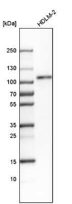 Western Blot: RAP80 Antibody [NBP1-87156] - Analysis in human cell line HDLM-2.