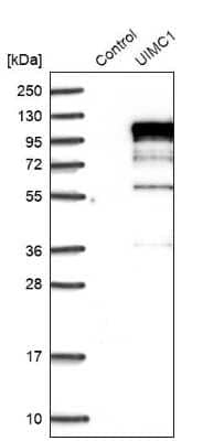 Western Blot RAP80 Antibody