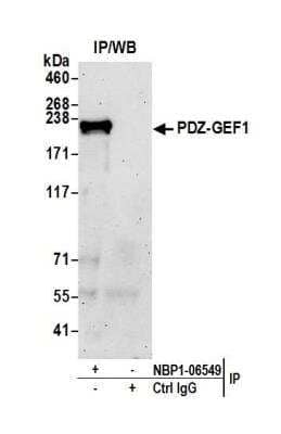 Immunoprecipitation: RAPGEF2 Antibody [NBP1-06549] - Detection of human PDZ-GEF1 by western blot of immunoprecipitates. Samples:Whole cell lysate (1.0 mg per IP reaction; 20% of IP loaded) from HeLa cells prepared using NETN lysis buffer. Antibodies: Affinity purified rabbit anti-PDZ-GEF1 antibody NBP1-06549 used for IP at 6 ug per reaction. For blotting immunoprecipitated PDZ-GEF1, NBP1-06549 was used at 0.4 ug/ml. Detection: Chemiluminescence with an exposure time of 3 minutes.