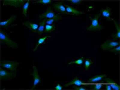 Immunocytochemistry/Immunofluorescence: RAPGEF3 Antibody [H00010411-D01P] - Analysis of antibody to RAPGEF3 on HeLa cell. Antibody concentration 30 ug/ml.