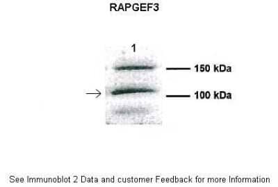 Western Blot: RAPGEF3 Antibody [NBP1-57045] - Human CFBE.