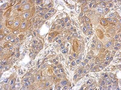 Immunohistochemistry-Paraffin: RAPGEFL1 Antibody [NBP2-20078] - Immunohistochemical analysis of paraffin-embedded Cal27 xenograft, using antibody at 1:500 dilution.