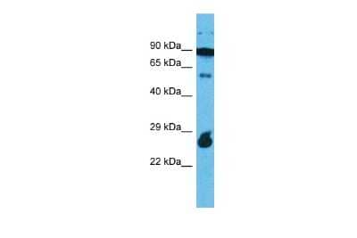 Western Blot: RAPGEFL1 Antibody [NBP2-86762] - Host: Rabbit. Target Name: RAPGEFL1. Sample Type: 721_B Whole cell lysates. Antibody Dilution: 1.0ug/ml