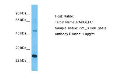 Western Blot: RAPGEFL1 Antibody [NBP2-86763] - Host: Rabbit. Target Name: RAPGEFL1. Sample Type: 721_B Whole Cell lysates. Antibody Dilution: 1.0ug/ml