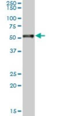 Western Blot: RAR alpha/NR1B1 Antibody (2C3) - Unpurified [H00005914-M09A] - Analysis of RARA expression in Hela S3 NE (Cat # L013V3).
