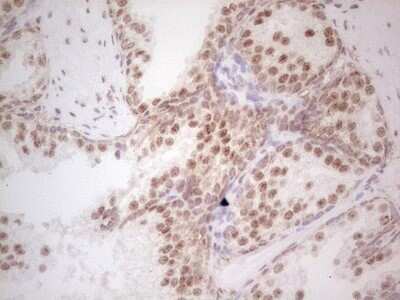 Immunohistochemistry: RAR alpha/NR1B1 Antibody (OTI2C3) - Azide and BSA Free [NBP2-73802] - Analysis of Human prostate tissue. (Heat-induced epitope retrieval by 1 mM EDTA in 10mM Tris, pH8.5, 120C for 3min)
