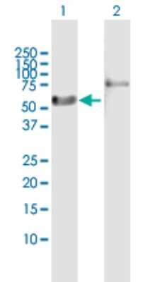 Western Blot: RAR alpha/NR1B1 Antibody [H00005914-B01P] - Analysis of RARA expression in transfected 293T cell line by RARA polyclonal antibody.  Lane 1: RARA transfected lysate(50.82 KDa). Lane 2: Non-transfected lysate.