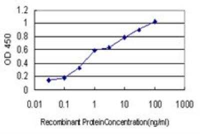 ELISA: RAR beta/NR1B2 Antibody (1F7) [H00005915-M01] - Detection limit for recombinant GST tagged RARB is approximately 0.1ng/ml as a capture antibody.
