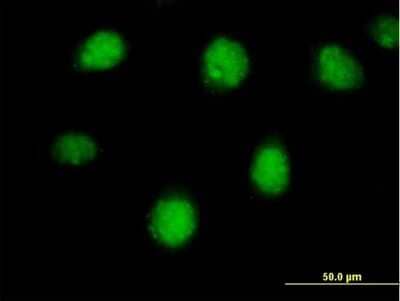 Immunocytochemistry/Immunofluorescence: RAR beta/NR1B2 Antibody [H00005915-B01P] - Analysis of purified antibody to RARB on HeLa cell. (antibody concentration 10 ug/ml)