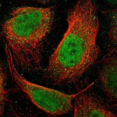 Immunocytochemistry/Immunofluorescence: RAR beta/NR1B2 Antibody [NBP1-81776] - Staining of human cell line U-2 OS shows localization to nucleoplasm. Antibody staining is shown in green.