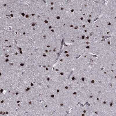 Immunohistochemistry-Paraffin: RAR beta/NR1B2 Antibody [NBP1-81776] - Staining of human cerebral cortex shows strong nuclear positivity in neurons.