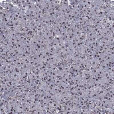 Immunohistochemistry-Paraffin: RAR beta/NR1B2 Antibody [NBP1-81776] - Staining of human pancreas shows weak nuclear positivity in  exocrine glandular cells.