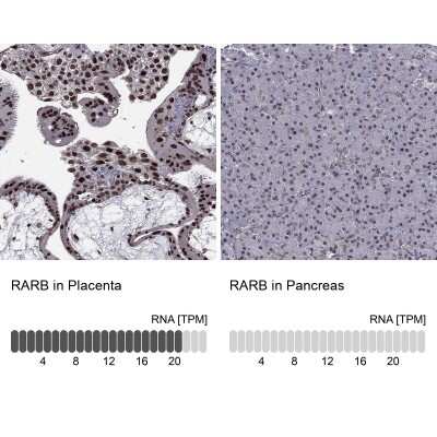 Immunohistochemistry-Paraffin: RAR beta/NR1B2 Antibody [NBP1-81776] - Analysis in human placenta and pancreas tissues using NBP1-81776 antibody. Corresponding RARB RNA-seq data are presented for the same tissues.