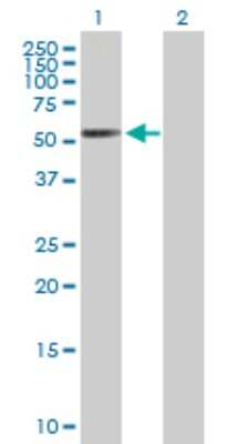 Western Blot: RAR beta/NR1B2 Antibody [H00005915-B01P] - Analysis of RARB expression in transfected 293T cell line by RARB polyclonal antibody.  Lane 1: RARB transfected lysate(49.28 KDa). Lane 2: Non-transfected lysate.