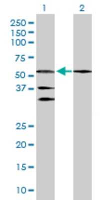 Western Blot: RAR beta/NR1B2 Antibody [H00005915-D01P] - Analysis of RARB expression in transfected 293T cell line by RARB polyclonal antibody.Lane 1: RARB transfected lysate(50.30 KDa).Lane 2: Non-transfected lysate.