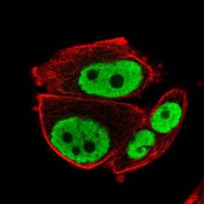 Immunocytochemistry/Immunofluorescence: RAR gamma/NR1B3 Antibody [NBP2-47314] - Staining of human cell line PC-3 shows localization to nucleoplasm. Antibody staining is shown in green.
