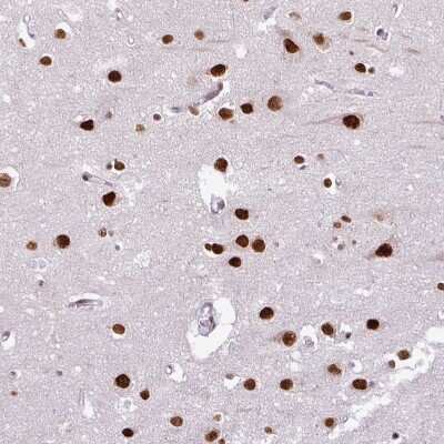 Immunohistochemistry-Paraffin: RAR gamma/NR1B3 Antibody [NBP2-47314] - Staining of human Cerebral cortex shows strong nuclear positivity in neuronal and glial cells.